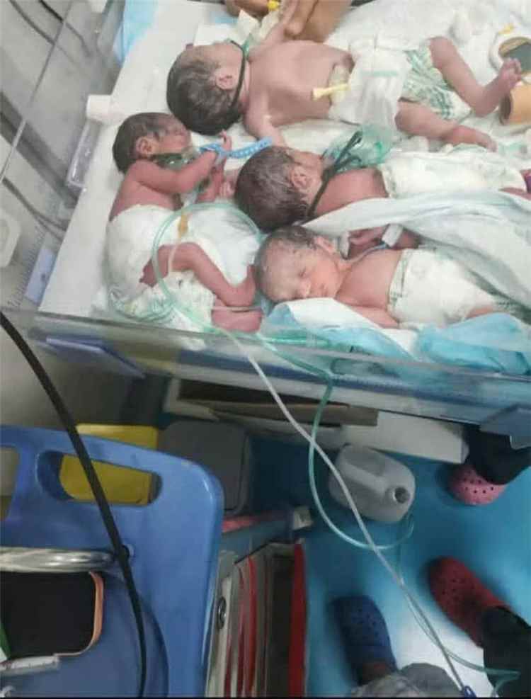 حالة نادرة في صنعاء.. ولادة 4 بنات توائم في مستشفى السبعين